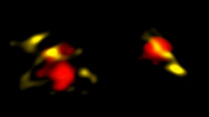 アルマ望遠鏡で観測した大量の塵を含む2つの銀河の画像